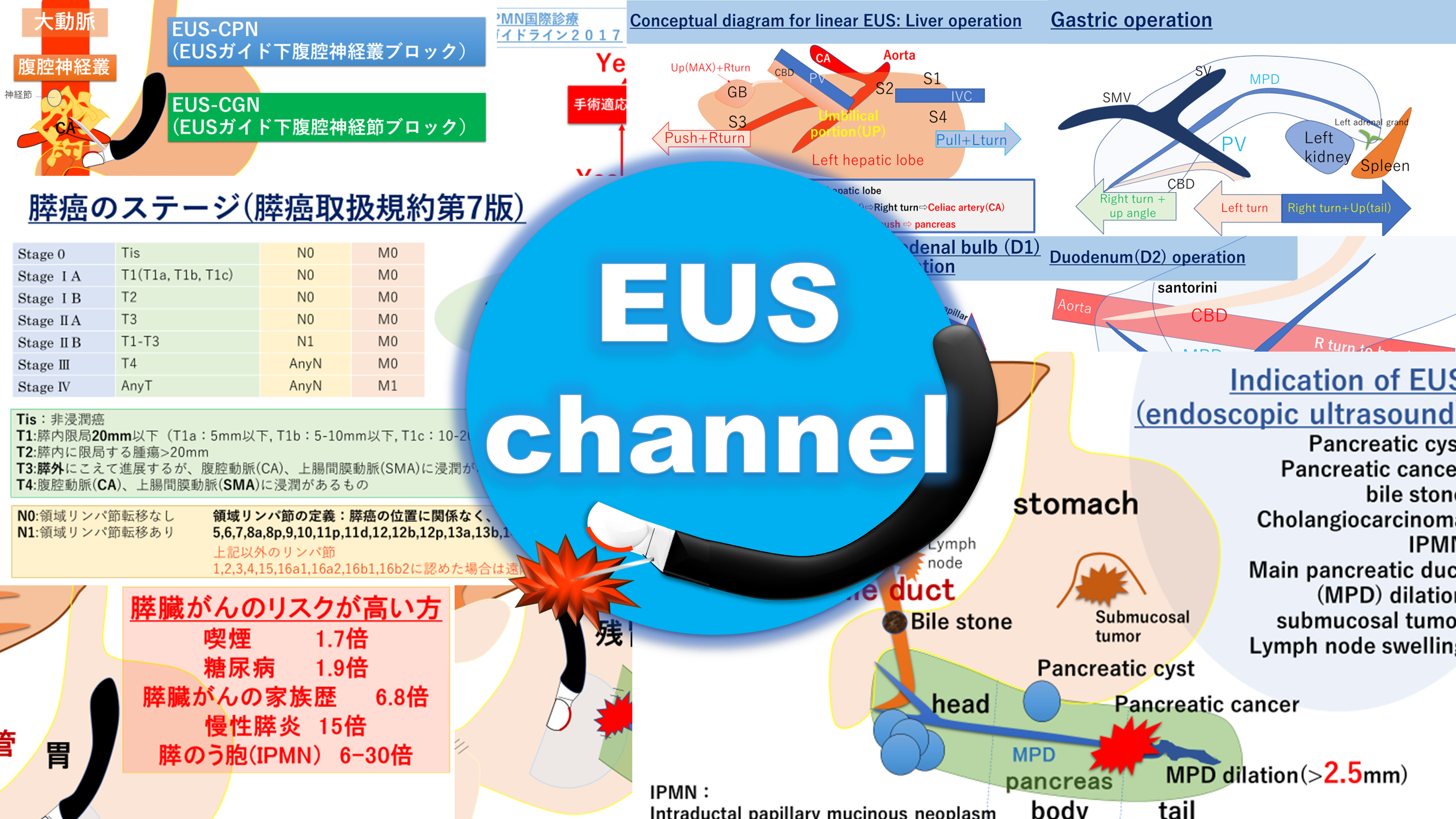 胆膵EUSセミナー 胆膵EUSセミナー〜CT・シェーマ・動画と合わせてわかる手技の